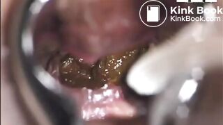 Einblick, ScatKings.com Scat Porn 11 ScatKings.com Scat Porn