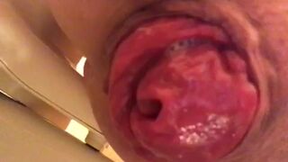 prolapse and shit18, ScatKings.com Scat Porn 3 ScatKings.com Scat Porn